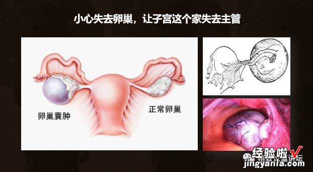 作为我们的“生命之房”，我们应该如何保护子宫？