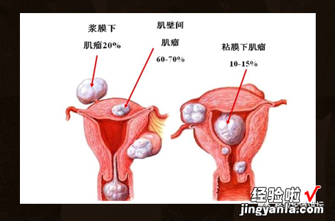 作为我们的“生命之房”，我们应该如何保护子宫？