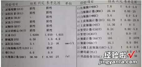 如何看懂化验单-如何看小便化验单